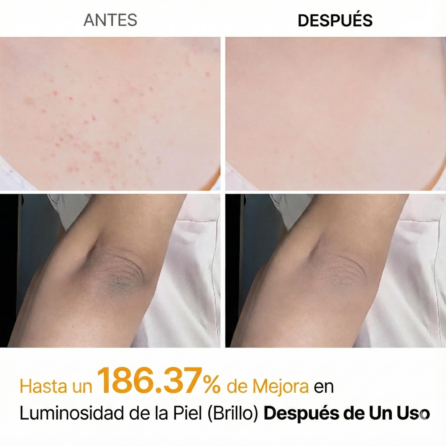 Dr. Melaxin Peel Shot Exfoliante y Aclarante para Áreas Oscuras del Cuerpo